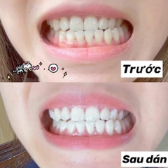 Set dán trắng răng Crest 3D 30 gói (Profes + Remove)