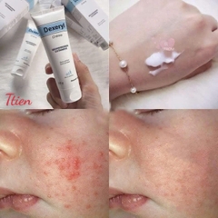 Kem bôi chàm sữa Dexeryl 50ml