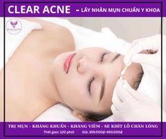 CLEAN ACNE<br>LẤY NHÂN MỤN CHUẨN Y KHOA