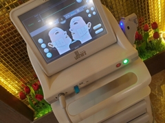 Máy nâng cơ xóa nhăn Hifu Ulthera