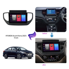 Mặt dưỡng màn Android Hyundai Accent 2021-2023 9 inch có tụ chống nhiễu