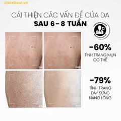 Sữa dưỡng thể MD CARE Calming & Moisturizing Acne Body Lotion 200ml
