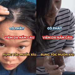 Kem Bôi Canova Rivescal DS 50ml – Giảm Viêm Da Tiết Bã, Ngăn Ngừa Nấm Ngứa, Làm Dịu Da