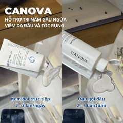 Dầu Gội Canova Rivescal DS 200ml – Giảm Viêm Da Đầu, Nấm Gàu, Mụn Đỏ, Viêm Da Tiết Bã, Làm Dịu Da Đầu, Kiểm Soát Nhờn Hiệu Quả