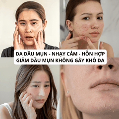 Gel rửa mặt ngừa mụn Canova Salipil Detergente Sifarma giúp loại bỏ bụi bẩn, tế bào chết, làm giảm và ngăn ngừa mụn (150ml)
