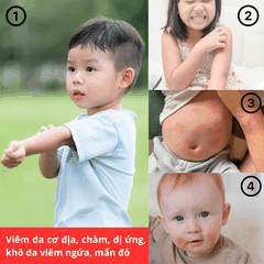 Nhũ tương bôi Latopic Probiotic Emollient Active Body Emulsion viêm da cơ địa chàm sữa, làm dịu da, giảm ngứa, giảm khô (250ml)