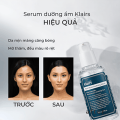 Serum dưỡng ẩm Klairs Rich Moist Soothing cấp ẩm phục hồi ngăn ngừa lão hoá da Hàn Quốc 80ml 