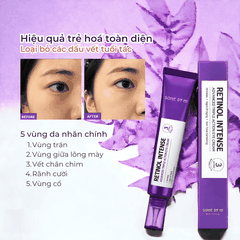 Kem mắt Some By Mi Retinol Intense Advanced Triple Action Eye Cream giảm thâm mắt dưỡng da mắt 30ml Hàn Quốc