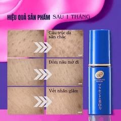 Serum Meishoku Placewhiter Serum Retinol và nhau thai giúp dưỡng trắng chống lão hoá và cấp ẩm 30ml Nhật Bản