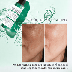 Nước Hoa Hồng Some By Mi làm sạch da dầu mụn trong 30 ngày AHA BHA PHA 30 Days Miracle Toner 150ml (HSD: 26/07/2025)