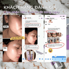 Kem dưỡng PrettySkin Retinal BakuChiol Night Cream tái tạo phục hồi trẻ hóa da Pretty Skin Retinol Hàn Quốc