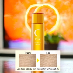 Nước hoa hồng Vitamin C Meishoku C Vita Bright Up Lotion dưỡng ẩm làm sáng da Vit C trái cây Nhật Bản 25ml (HSD: 02/08/2025)