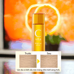 Vitamin C Serum và Lotion Meishoku C Vita dưỡng trắng da dưỡng ẩm tự nhiên từ cam Yuzu Nhật Bản