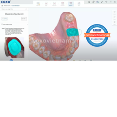 Máy quét scan trong miệng COXO DL-300P