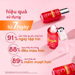 Dưỡng chất Pond's ngăn ngừa lão hóa chuyên sâu 30ml.