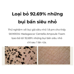 Sữa rửa mặt Skin1004 Madagascar Centella Ampoule Foam 125ml
