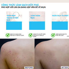 Gel rửa mặt & tắm La Roche-Posay làm sạch và giảm mụn 400ml