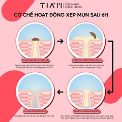 Kem chấm mụn Tia'm giảm mụn, mờ thâm, liền sẹo 30ml