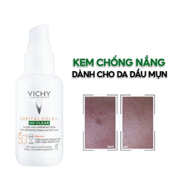 Kem chống nắng Vichy dành cho da dầu mụn 40ml