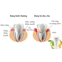 Kem đánh răng trẻ em không Flouride NUK 3-36 tháng (50ml)