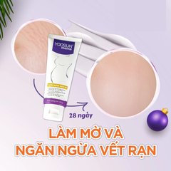 Kem ngăn ngừa rạn da Yoosun Mama 100g