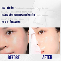 Mặt nạ Sur.Medic+ tinh chất Glutathione làm sáng da 30g