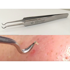 Nhíp lấy mụn Vacosi Blackhead Tweezers T07