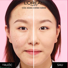 Phấn nền L’Oréal che phủ cao 20 Ivory/120 Vanilla cho tông sáng/tông tự nhiên 9g