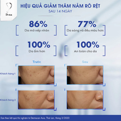 Serum D-na dưỡng sáng chuyên sâu, mờ sạm nám 30g