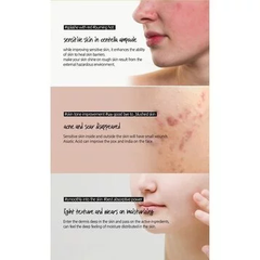 Serum Skin1004 rau má giảm mụn & phục hồi da 30ml/55ml/100ml