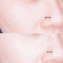 Serum So'Natural làm giảm mụn, tái tạo làn da 35ml