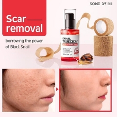 Serum Some By Mi ốc sên phục hồi da mờ thâm sẹo 50ml