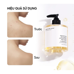 Sữa tắm Grace And Glow English Pear giảm mụn, mẩn đỏ 400ml