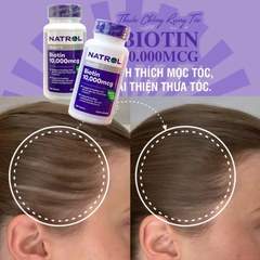 Viên uống mọc tóc Natrol Biotin 10000 mcg (100 viên)
