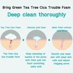 Sữa rửa mặt Care:Nel White Renew Soft làm sạch da, dưỡng ẩm, ngừa mụn 180ml