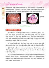 Đông Y Thiệt Chẩn