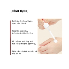 Serum Tinh Chất Peel White So Natural 11ML-35ML- Dưỡng Trắng, Cải thiện Tàn Nhang & Cấp Ẩm Sâu Chỉ Sau 1 Đêm