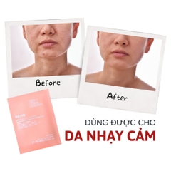 Mặt nạ nhau thai cừu cuống rốn tế bào gốc Nhật Bản Rwine Beauty dưỡng da, cung cấp độ ẩm, tái tạo collagen