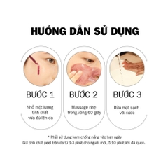Serum Tinh Chất Red Peel So Natural - Peel Da Lành Tính, Đào Thải Tế Bào Chết & Làm Sáng 11ML-35ML
