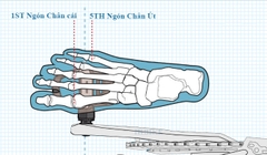 Dụng Cụ Điều Chỉnh Can Giày Xe Đạp LEBYCLE