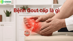 Bệnh Gout cấp là gì và điều trị như thế nào?