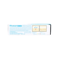 Gel Hirusca Post Acne hỗ trợ làm mờ thâm mụn, sẹo mụn (hộp 1 tuýp x 10g)