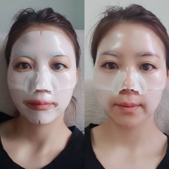 MẶT NẠ DERM-ALL MATRIX FACIAL DERMAL - CARE MASK