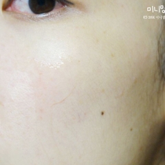 SERUM GOODNDOC HYDRA B5
