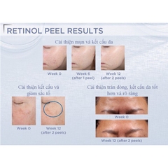 PEEL NEOSTRATA PROSYSTEM RETINOL PEEL - 1.5ML
