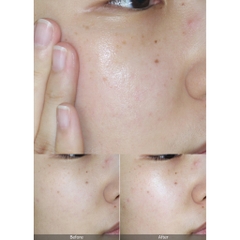 KEM DƯỠNG KLAIRS MIDNIGHT BLUE CALMING CREAM