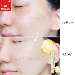 KEM MẮT SUR.MEDIC+