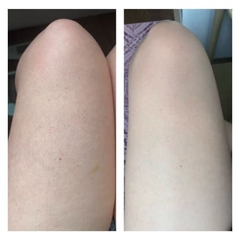 KEM BODY 2% BHA PAULACHOICE SKIN REVEALING BODY LOTION