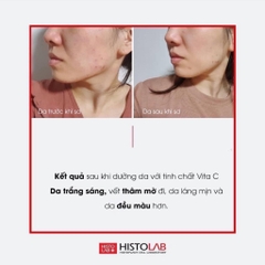 SERUM HISTOLAB 47% VITA C