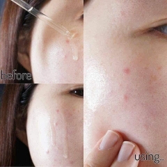 SERUM GOODNDOC HYDRA B5